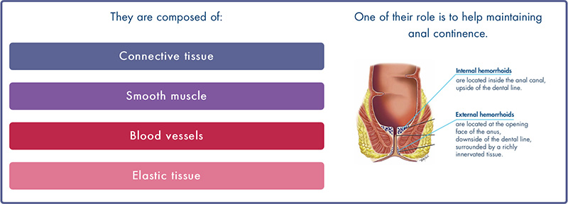 Hemorrhoids